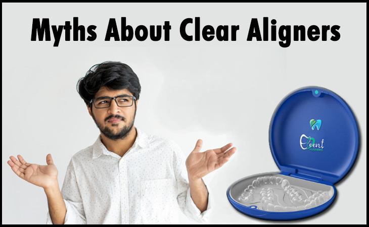 Common Misconceptions About Clear Aligners