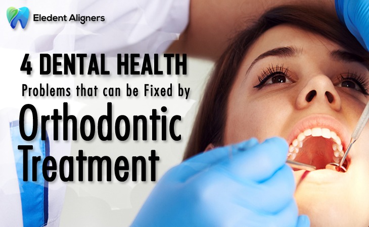Here are 4 of the preeminent normal issues treated with orthodontics