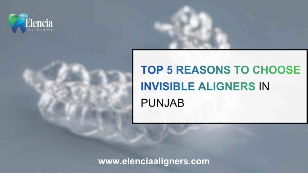 Top 5 Reasons to Choose Invisible Aligners in Punjab