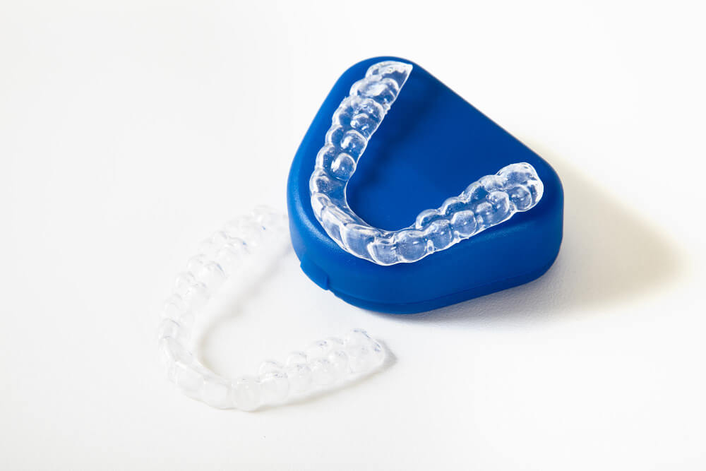 Invisible Aligners in Punjab