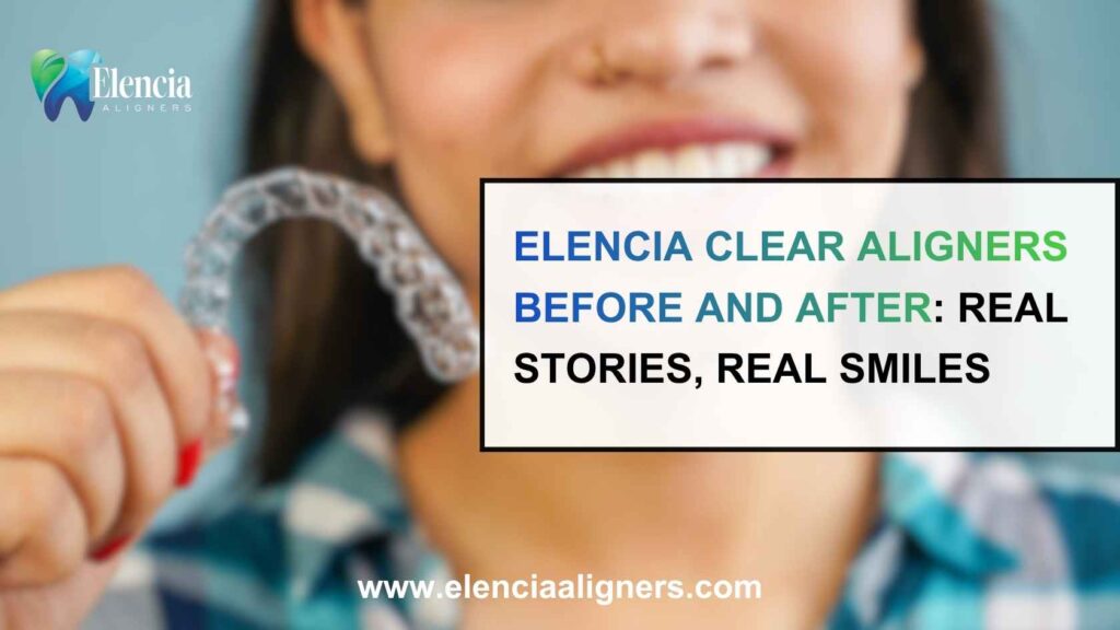 clear aligners before and after