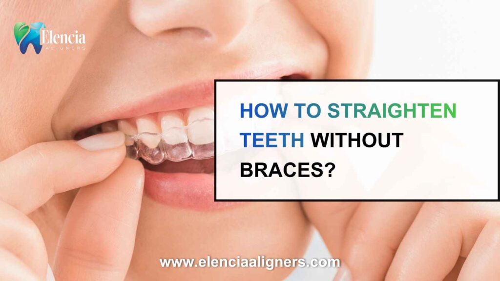 How to Straighten Teeth Without Braces