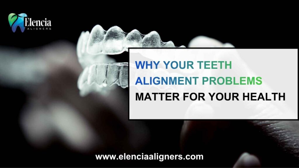 teeth alignment problems