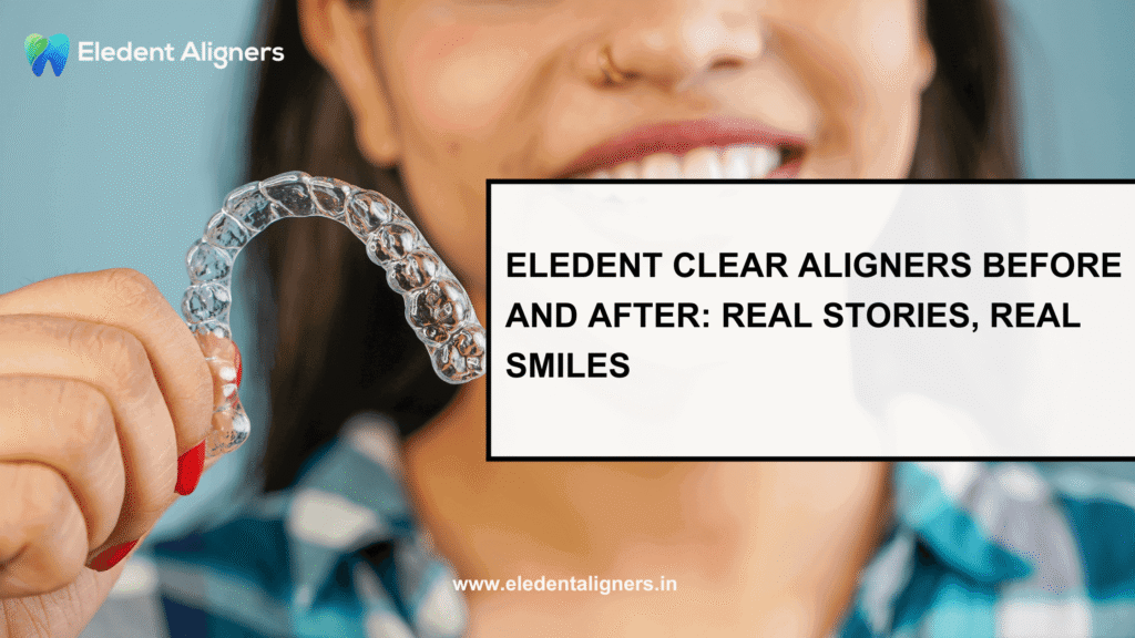 clear aligners before and after
