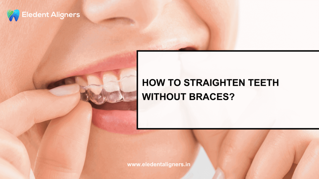 How to Straighten Teeth Without Braces