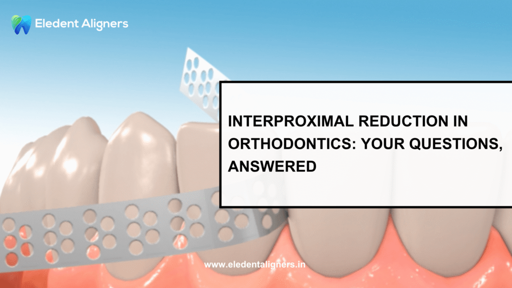 Interproximal Reduction in Orthodontics
