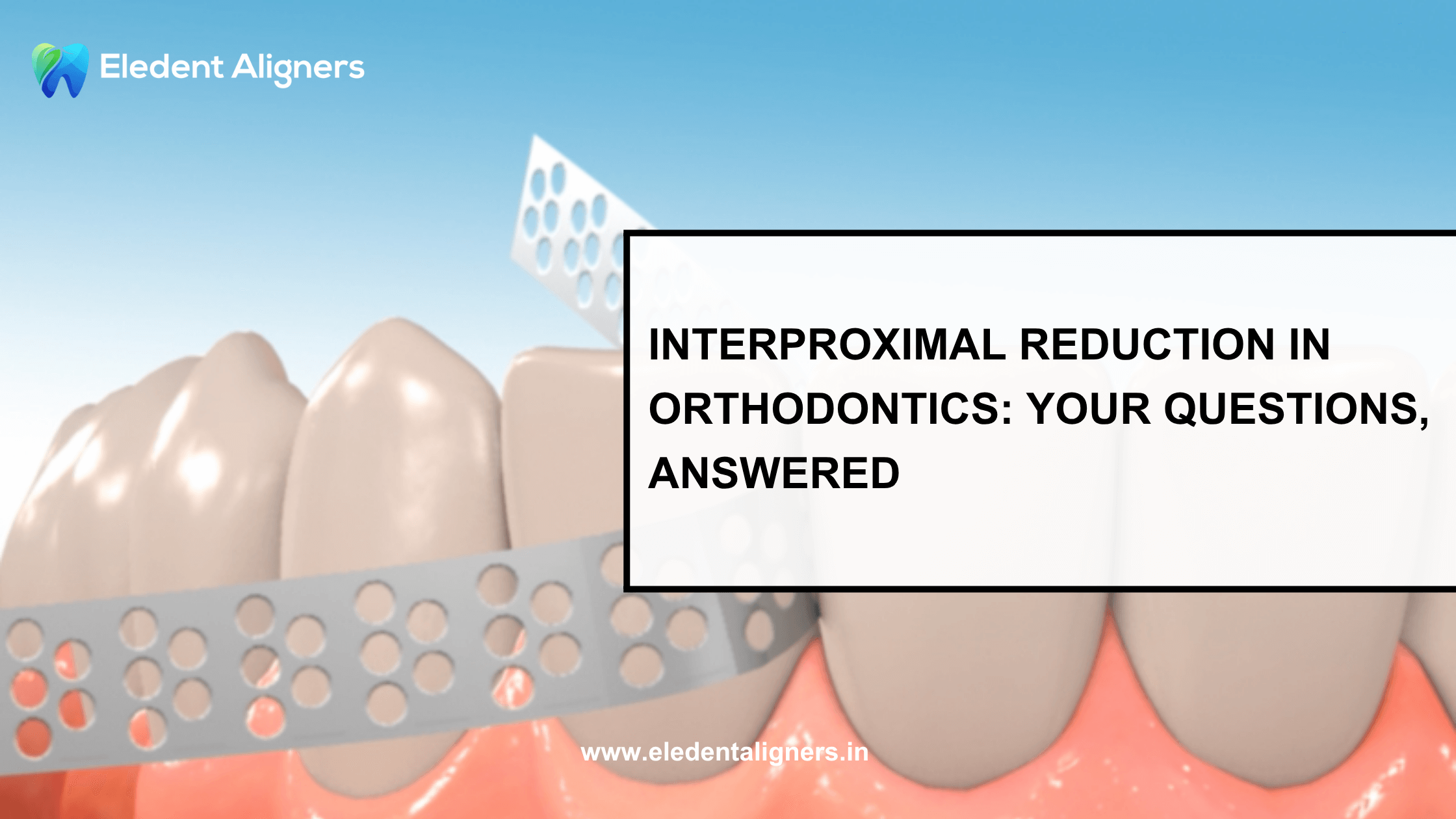 Interproximal Reduction in Orthodontics: Your Questions, Answered