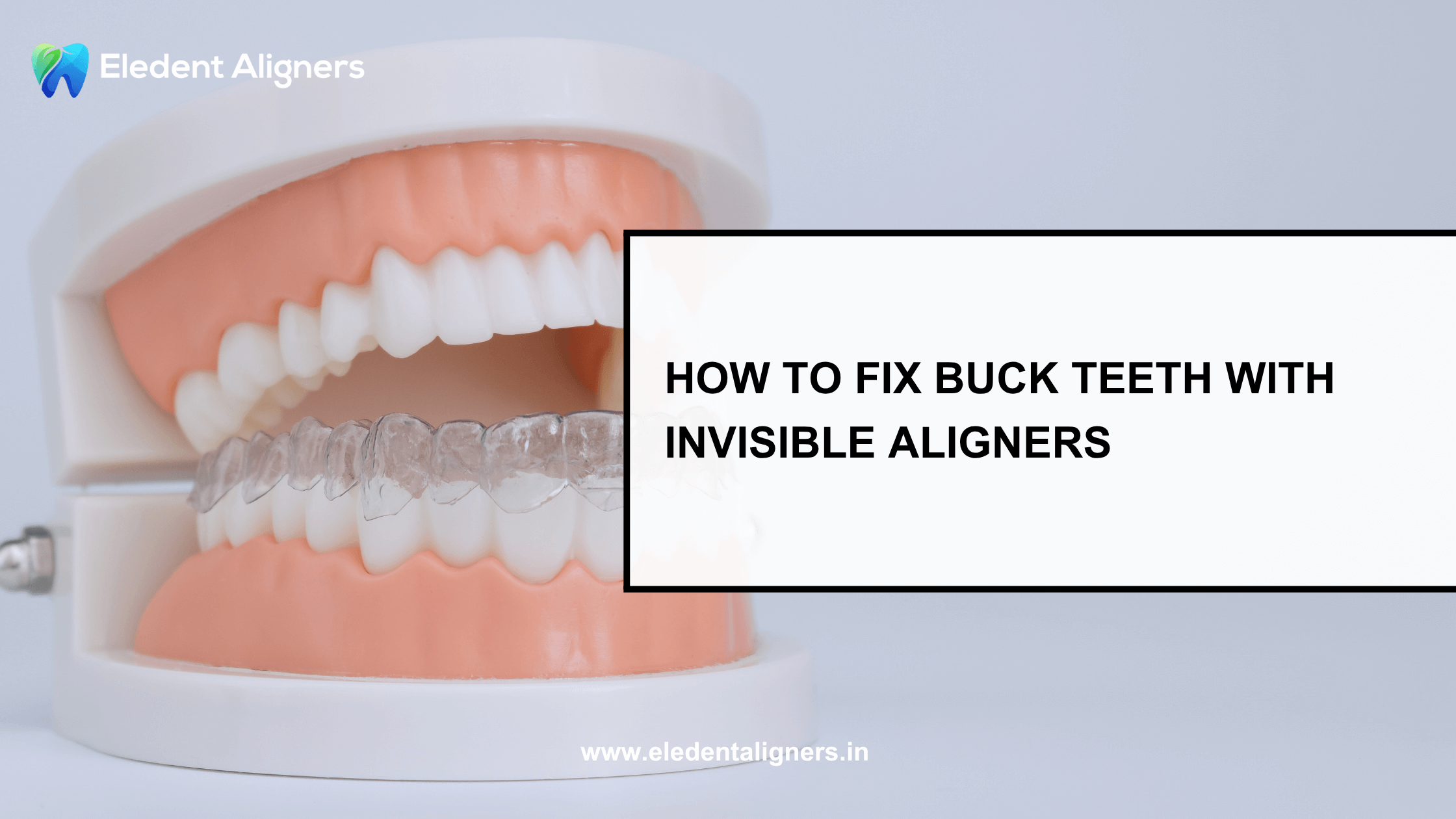 How to Fix Buck Teeth with Invisible Aligners