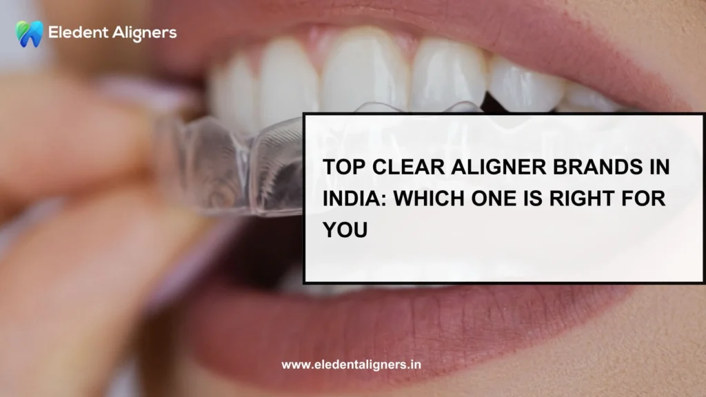 Top Clear Aligner Brands in India