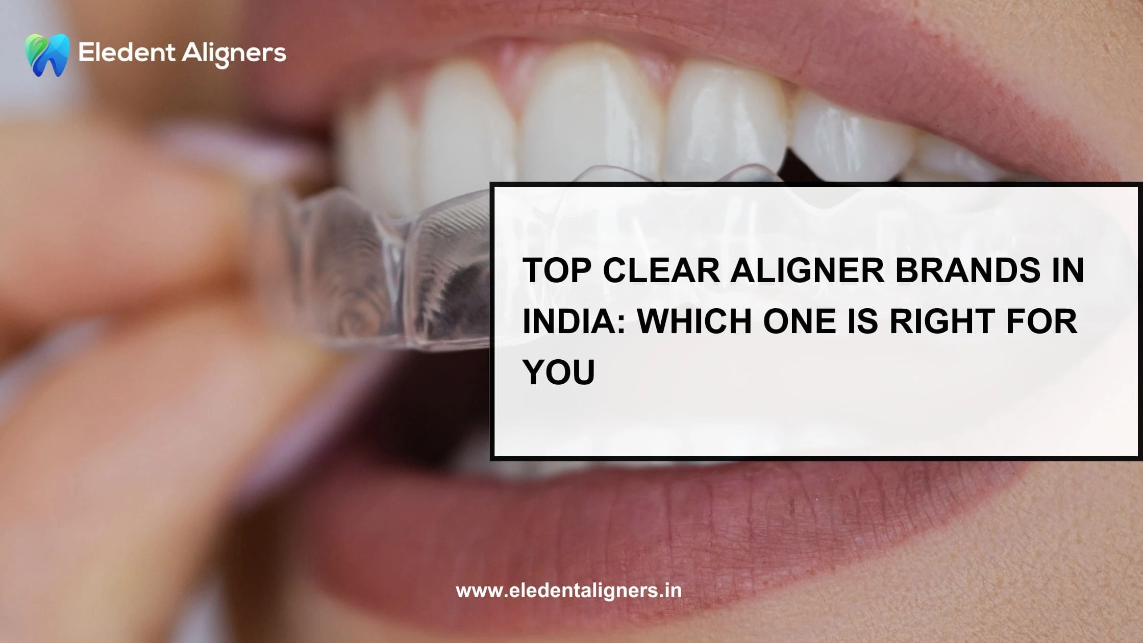 Top Clear Aligner Brands in India: Which One is Right for You