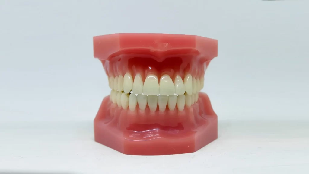 Understanding Complex Cases in Orthodontics