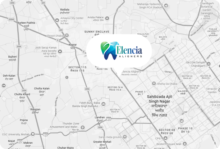 Elencia Aligners serving patients across Mohali and Chandigarh