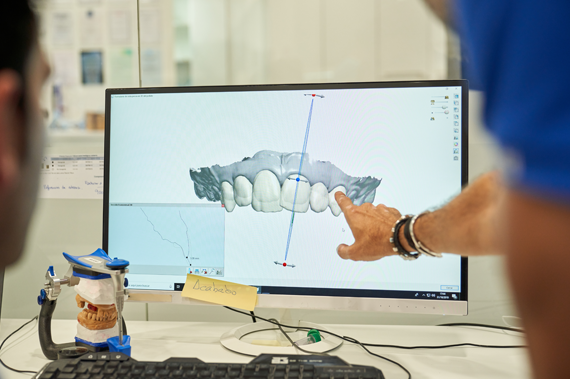 Digital smile planning for customized aligner treatment