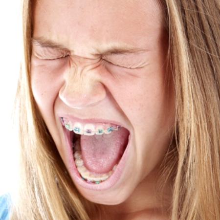 Discomfort often associated with traditional braces treatment
