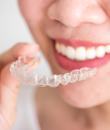 Patient wearing clear aligners for smile correction