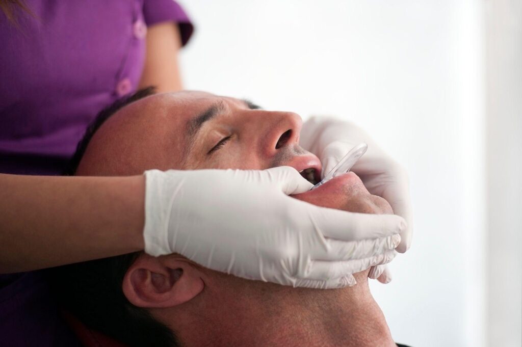 aligners impressions taking