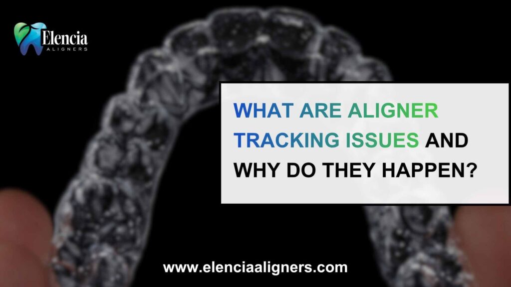 What Are Aligner Tracking Issues and Why Do They Happen?