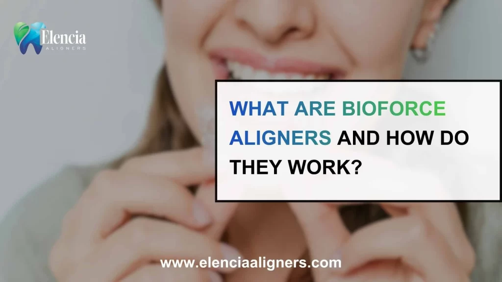 What Are BioForce Aligners and How Do They Work?