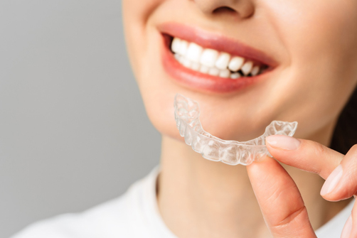 elencia aligners