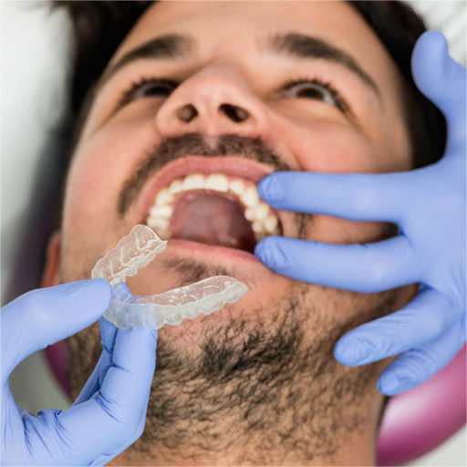 Crword-teeth-img