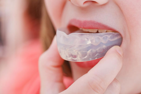 Open-Bite-img-Side