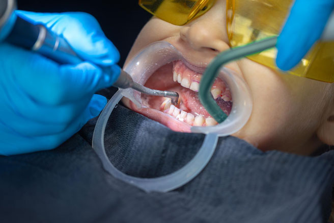 What-Proclination-Correction-img