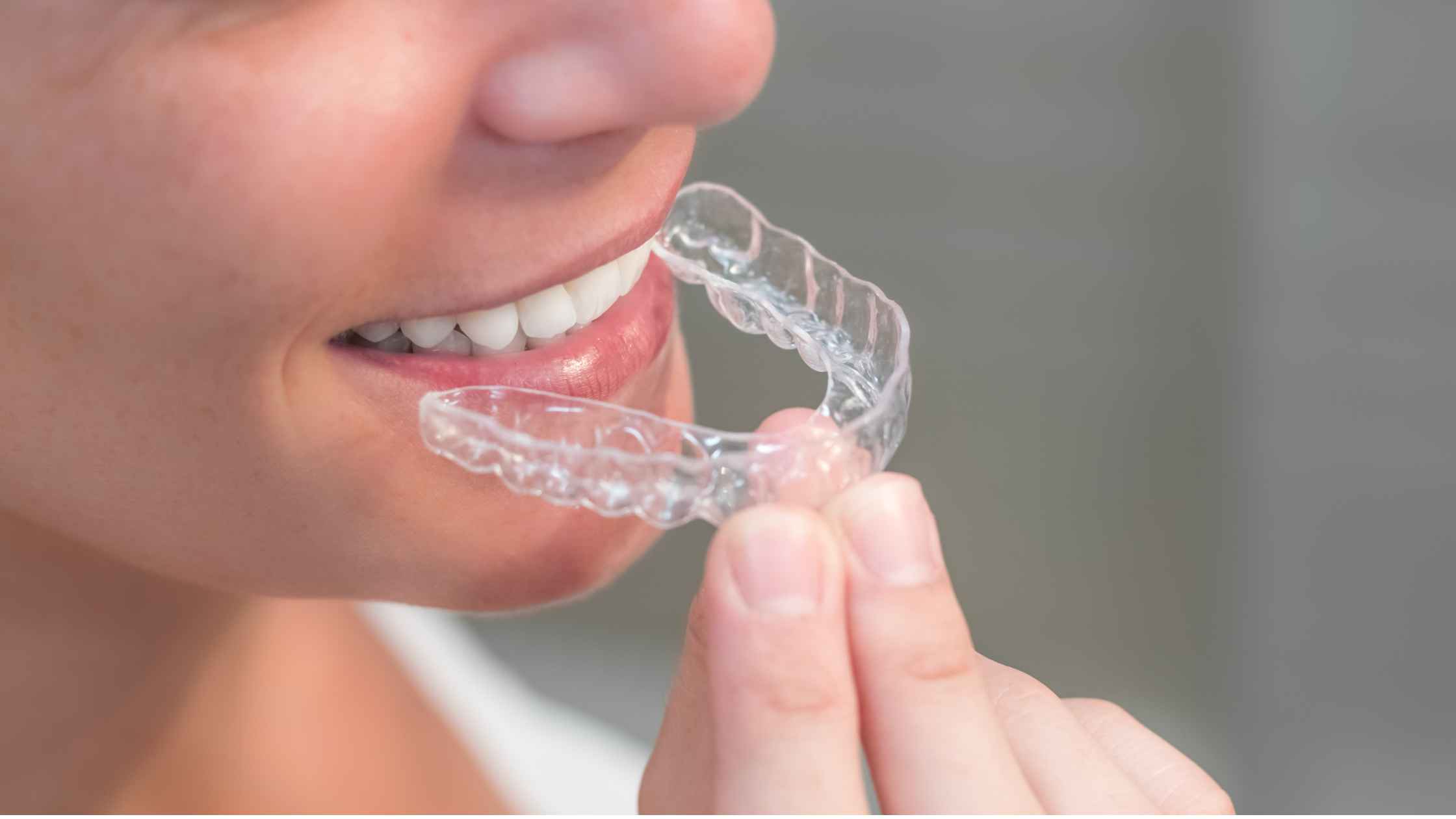 Patient holding a clear dental aligner near their teeth
