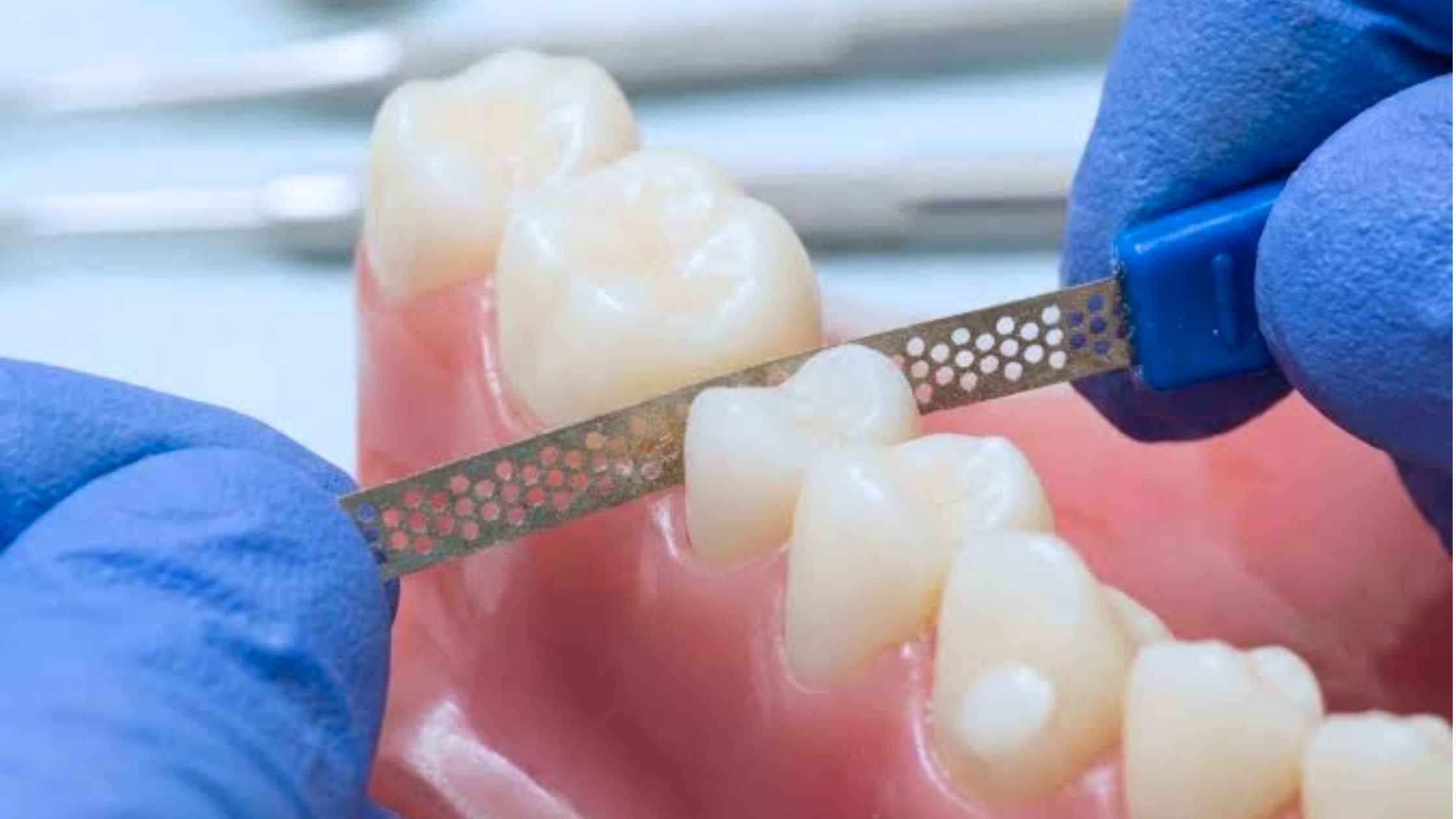 Close-up of a dentist performing interproximal reduction (IPR) using a dental strip between teeth during orthodontic treatment.