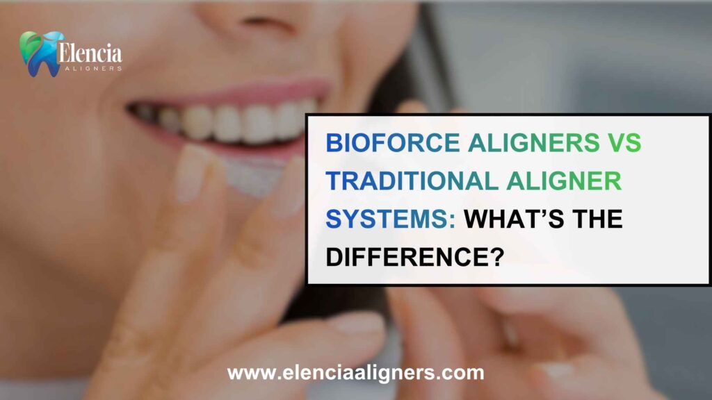 BioForce Aligners vs traditional aligner systems comparison