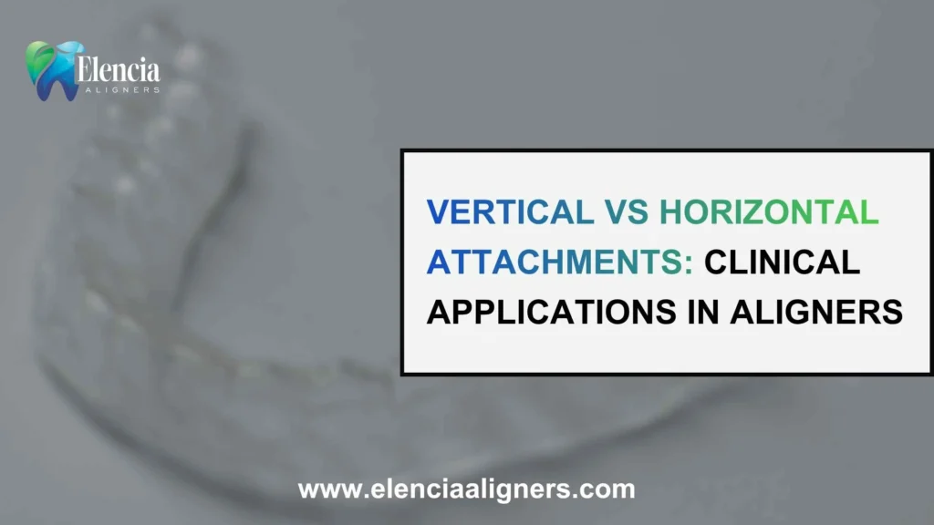 Vertical vs Horizontal Attachments