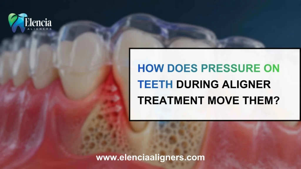 How Does Pressure on Teeth During Aligner Treatment Move Them